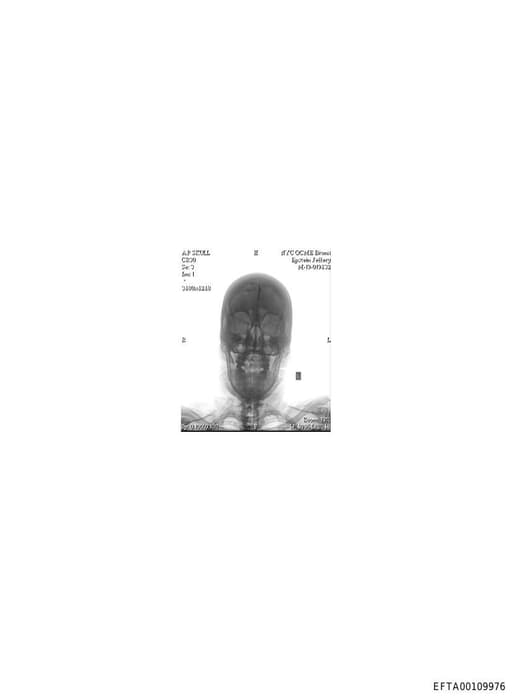 Preview of EFTA00109976