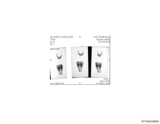 Preview of EFTA00109999